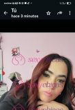 ZORRITA PELUDITA🔥soy una linda XL oral sin gorrito🍑🍆sin gorrito